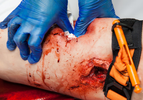 Wound packing Thigh